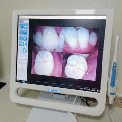 YF-1700P+ 17 inch tandheelkundige intraorale camera touchscreen LCD-scherm voor tandheelkundige unit met beugel