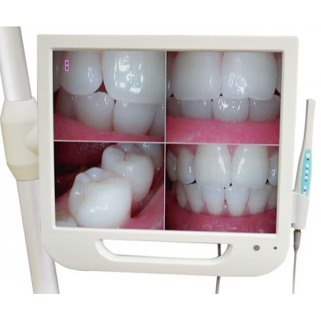 17 Inch hoge definitie wifi digitale LCD-monitor tandheelkundige intra-orale camera