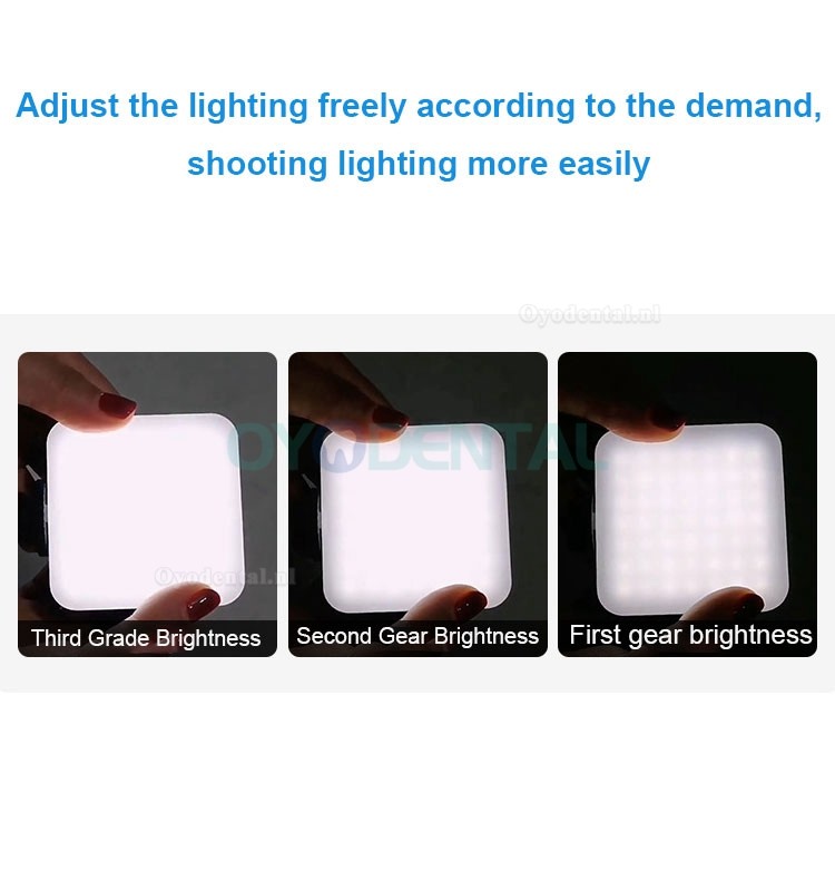 Tandheelkundige aanpassing Orale fotografie Flitslicht Mobiele telefoon Tandheelkundige fotografie Invullicht