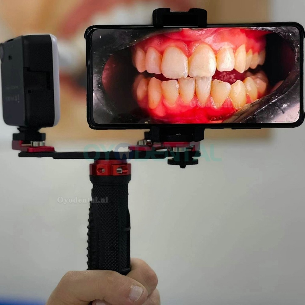 Tandheelkundige aanpassing Orale fotografie Flitslicht Mobiele telefoon Tandheelkundige fotografie Invullicht
