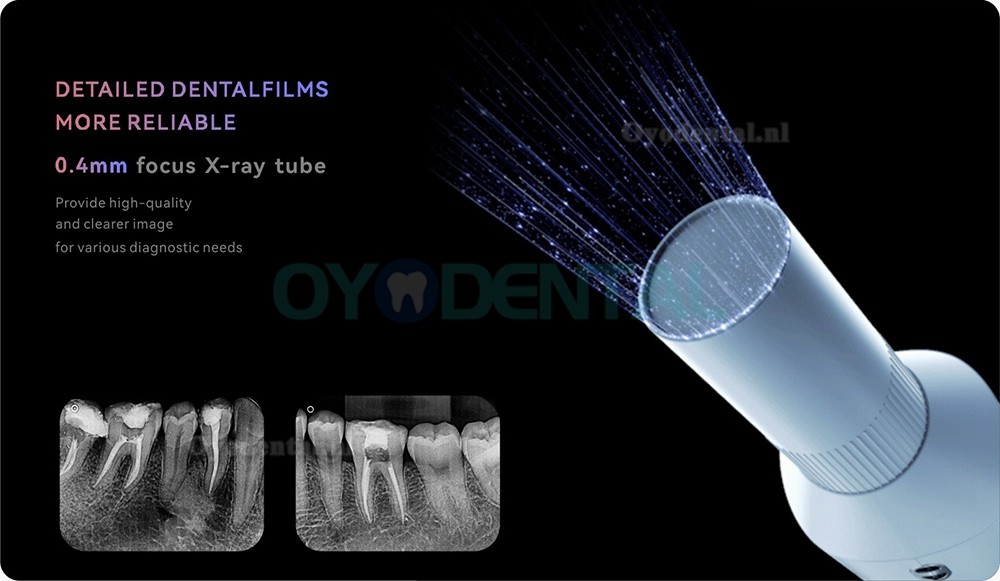 Woodpecker Ai Ray Touch Screen draagbare tandheelkundige röntgenmachine hoge frequentie