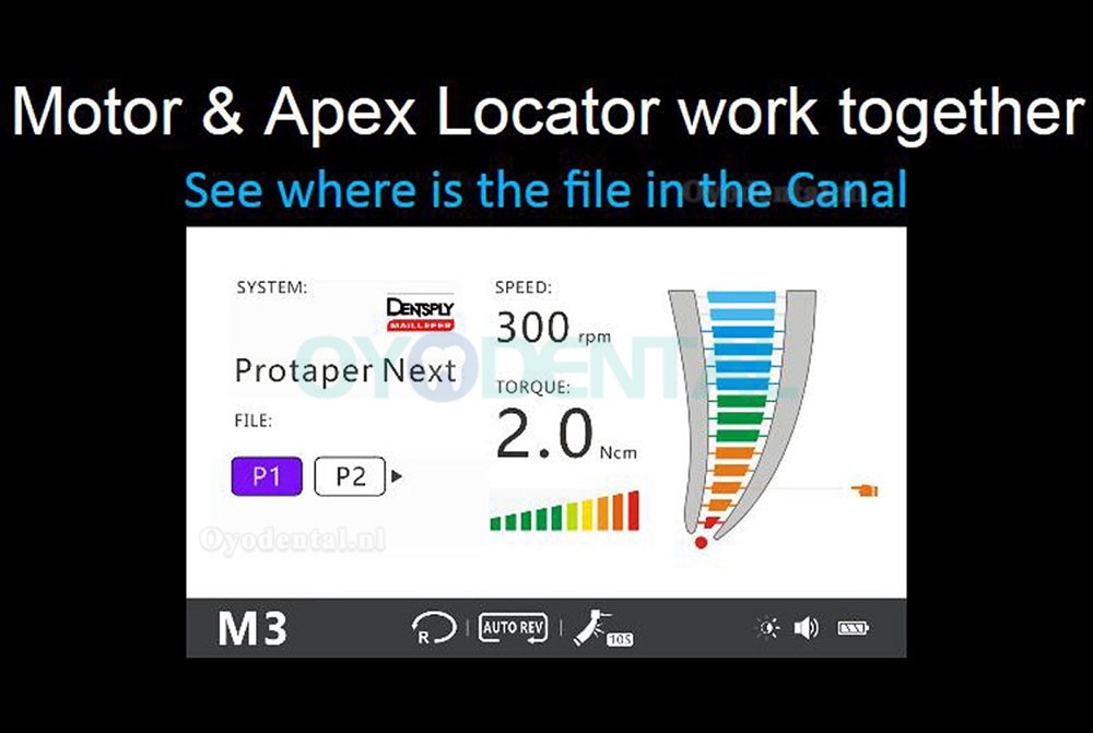 Yusendent COXO endodontische behandeling Endodontische motor met Apex Locator C Smart I Pro