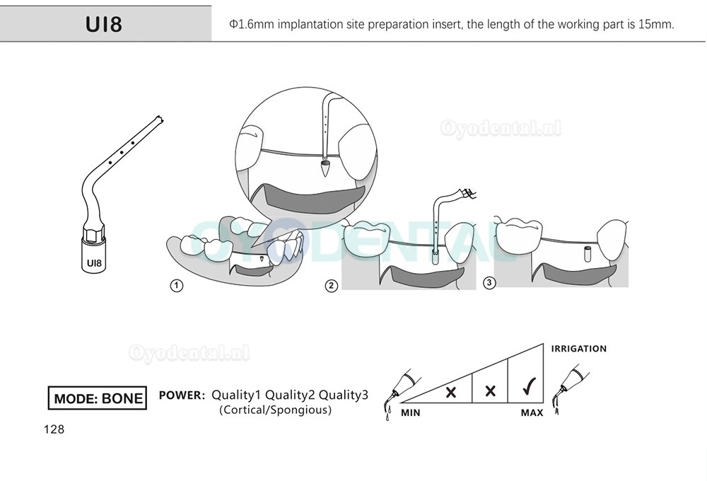 1Pcs Tips voor tandheelkundige piëzochirurgie voor botsnijden sinus lifting implantaat Ul1 UI2 UI3 UI4 UI5 compatibel met Mectron Woodpecker