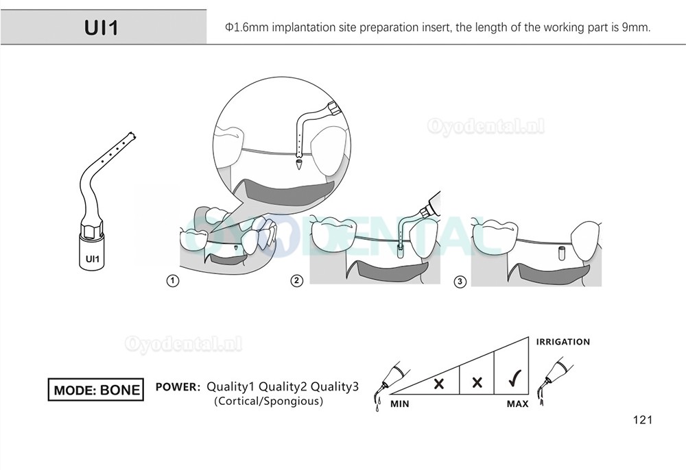 1Pcs Tips voor tandheelkundige piëzochirurgie voor botsnijden sinus lifting implantaat Ul1 UI2 UI3 UI4 UI5 compatibel met Mectron Woodpecker