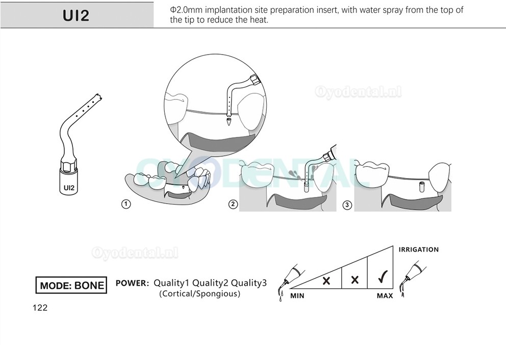 1Pcs Tips voor tandheelkundige piëzochirurgie voor botsnijden sinus lifting implantaat Ul1 UI2 UI3 UI4 UI5 compatibel met Mectron Woodpecker