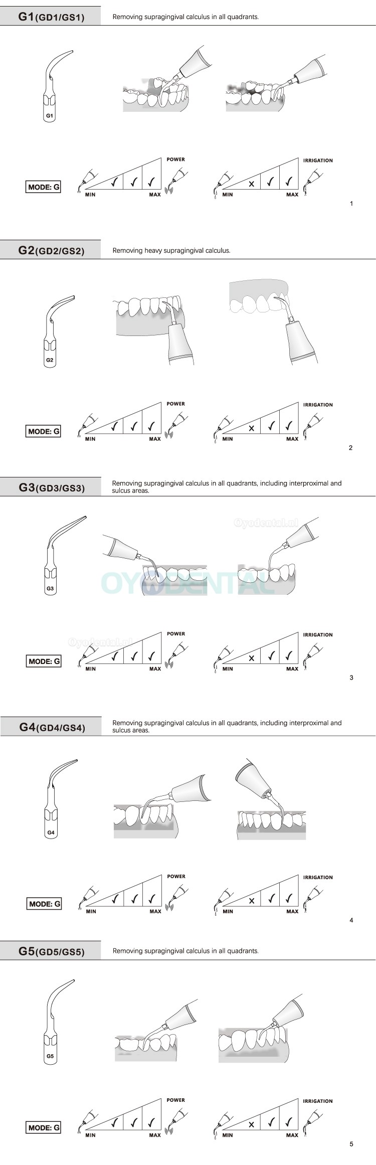 10Pcs Ultrasoon tips G1 G2 G3 G4 G5 G6 GD1 GD2 GD3 GD4 GD5 GD6 compatibel met EMS Woodpecker