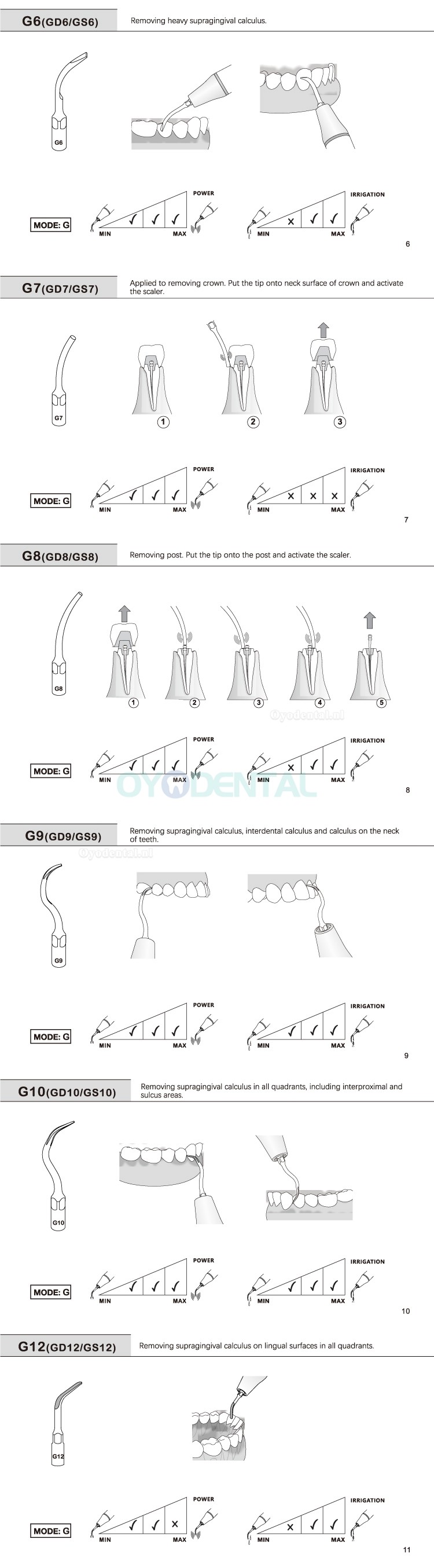 10Pcs Ultrasoon tips G1 G2 G3 G4 G5 G6 GD1 GD2 GD3 GD4 GD5 GD6 compatibel met EMS Woodpecker