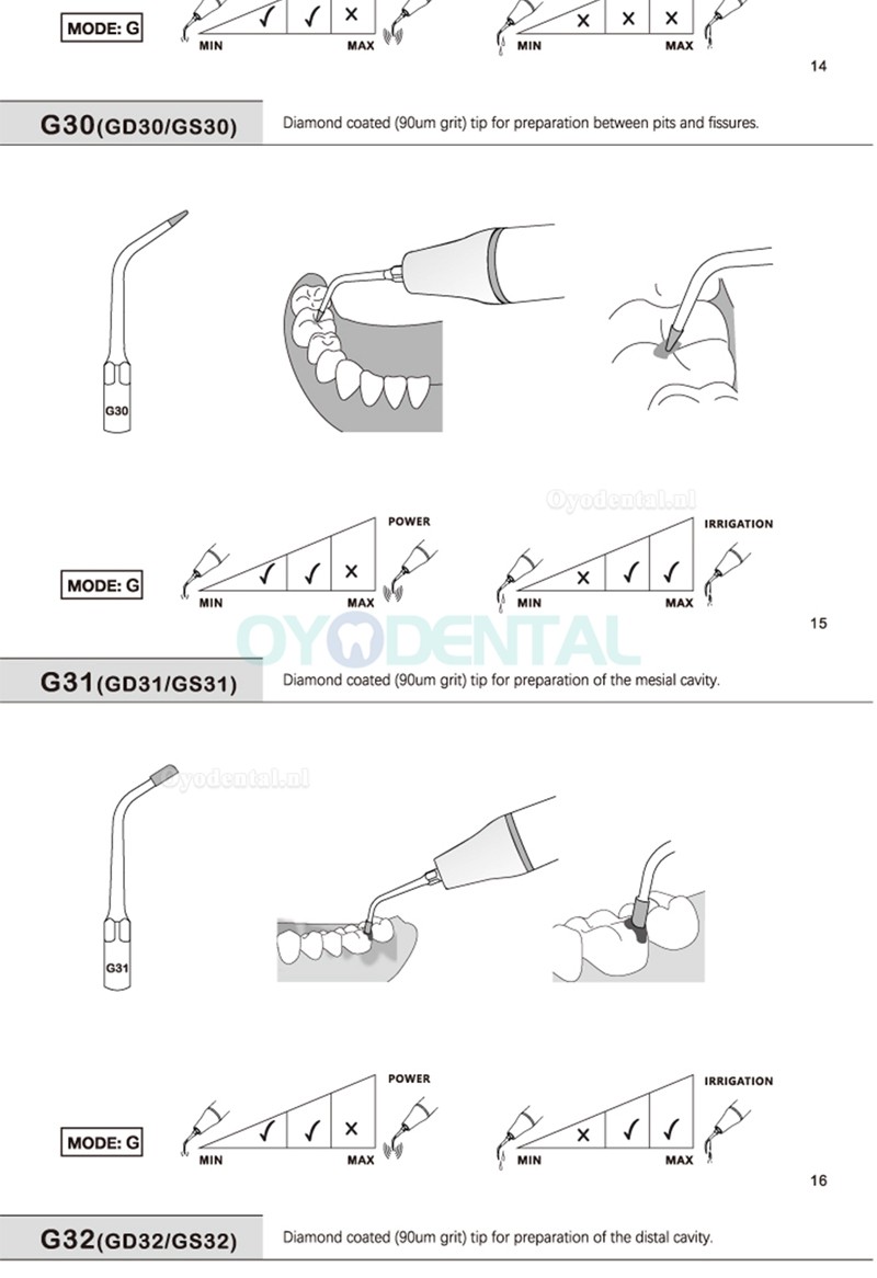 5Pcs Tandarts tips G20 G21 G30 G31 G32 G33 G35 compatibel met REFINE EMS Woodpecker scaler handstuk