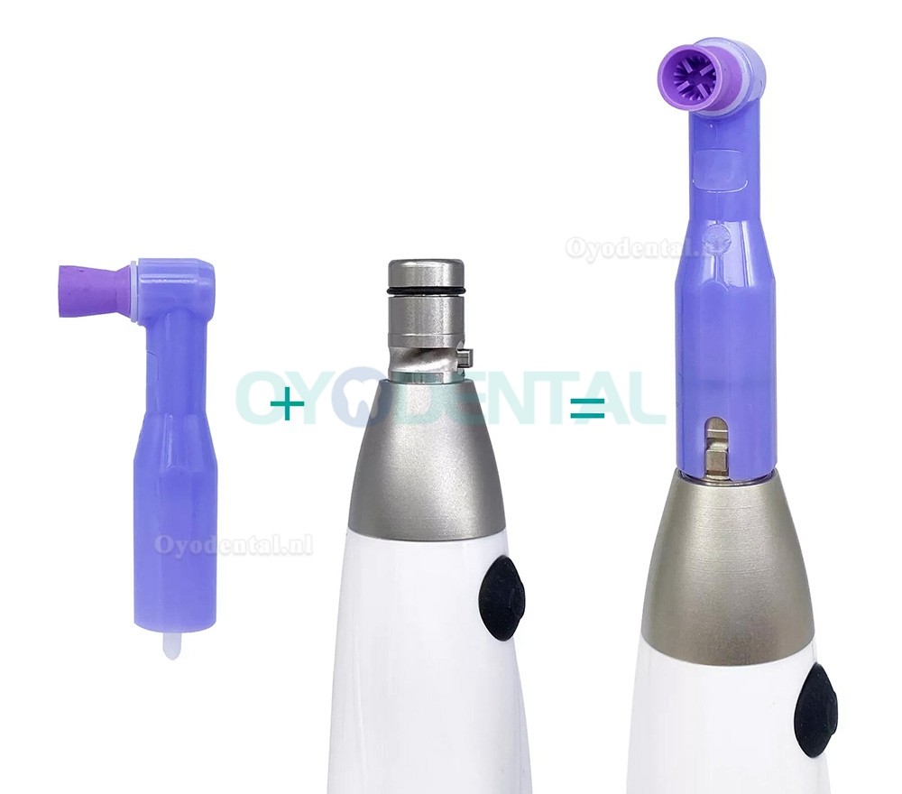 I-Prophy Elektrische draadloze tandheelkundige hygiëne profylaxe handstuk 360° draaibaar I-Prophy Elektrische draadloze tandheelkundige hygiëne profylaxe handstuk 360° draaibaar