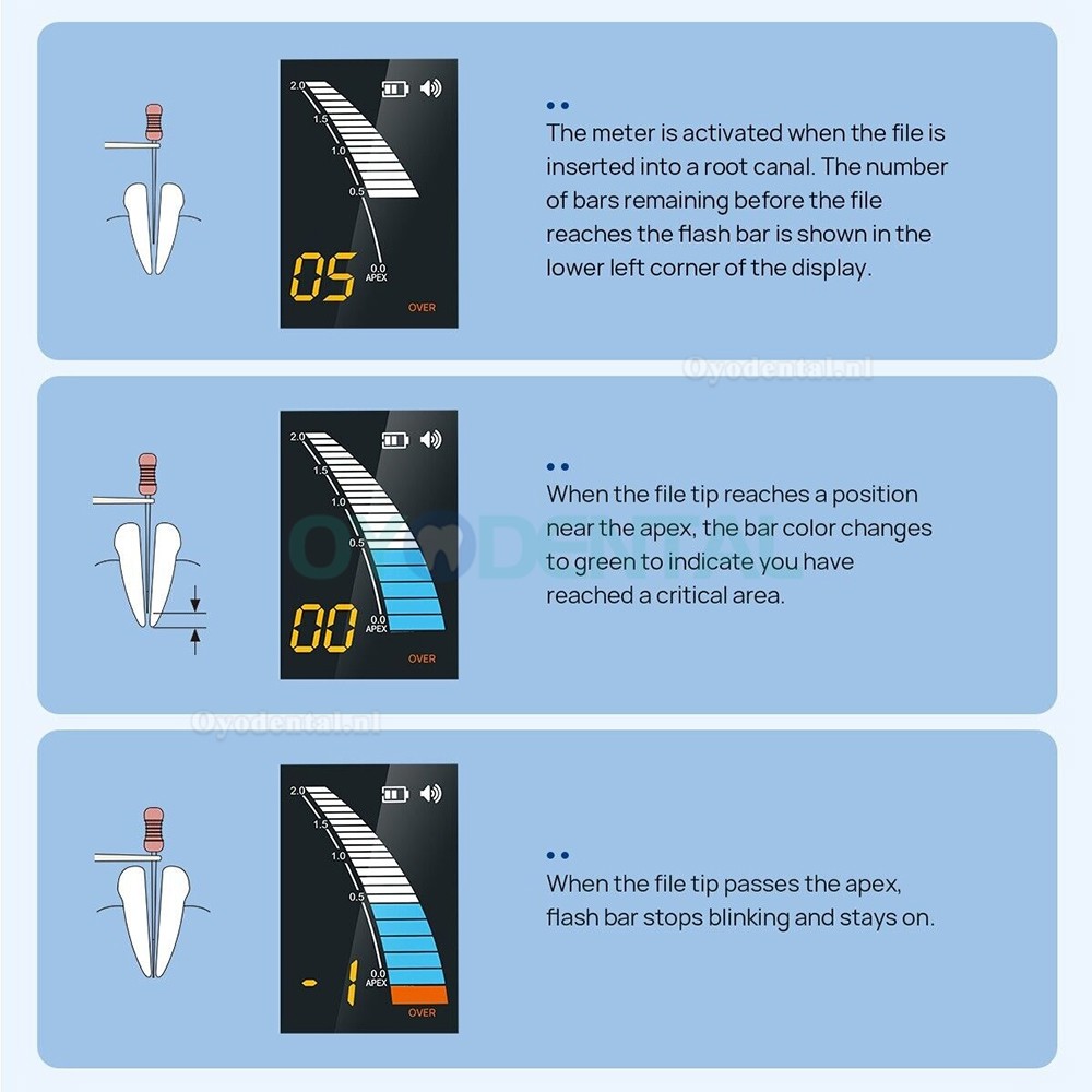 Micropex Pro Endodontische wortelkanaalzoeker Apex Locator voor kanaallengtemeting