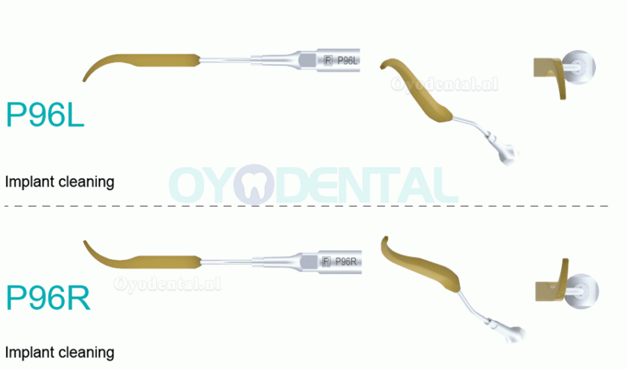 5Pcs Ultrasoon tips voor implantaatreiniging P90 P94 P95 P96L P96R compatibel met REFINE EMS MECTRON Woodpeaker