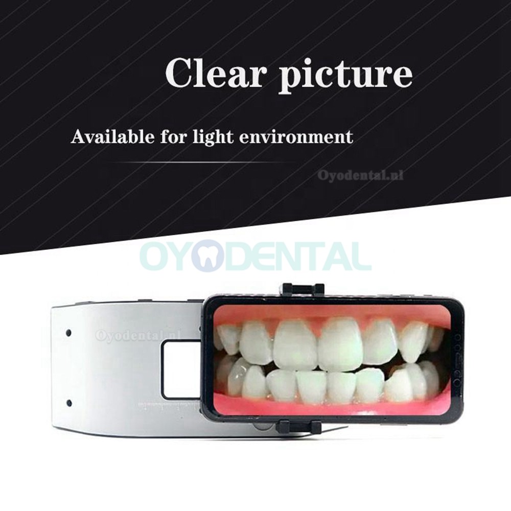 Draagbaar tandheelkundig fotografie-vullicht mobiele telefoon zaklamp oraal LED-vullicht voor tandartsen