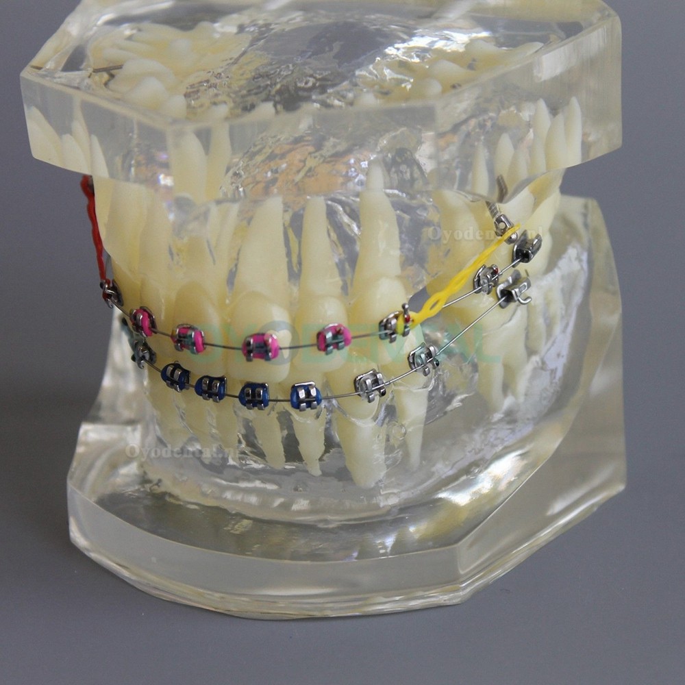 Tandheelkundige Orthodontische demonstratie praktijkmodel met metalen beugel Archwire