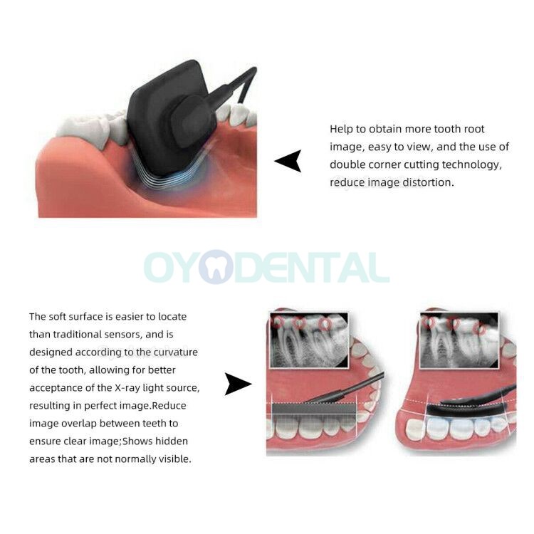 Intra-orale tandheelkundige röntgensensor RVG tandheelkundig intraoraal beeldvormingssysteem
