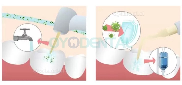 Refine MaxSurgery Tandheelkundig piëzochirurgiesysteem Ultrasoon piëzo-botchirurgiesysteem Piezo-chirurgiemachine