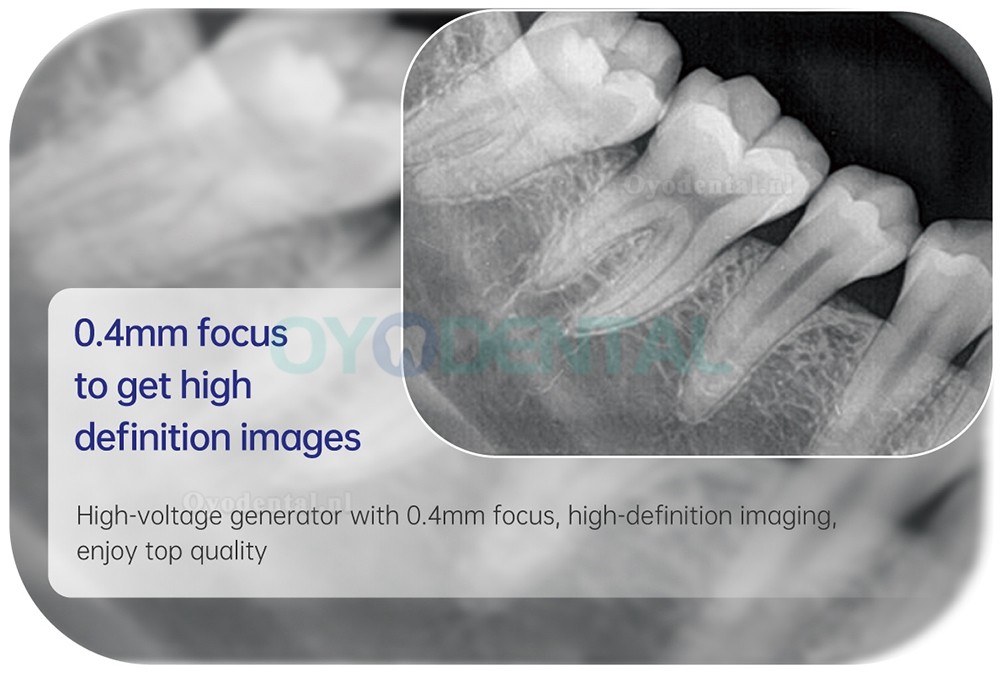 Refine VeRay digitale draagbare tandheelkundige röntgencamera hoge frequentie