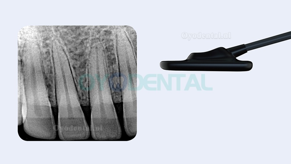 Refine VeRay draagbare tandheelkundige röntgenunit + intra-orale sensor kit