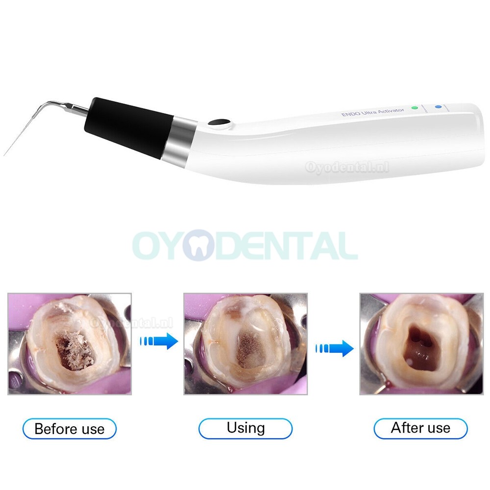Dental Sonic Endodontische Irrigator Ultrasone Ultra-activator Handstuk + 6 Pcs Titanium Tips