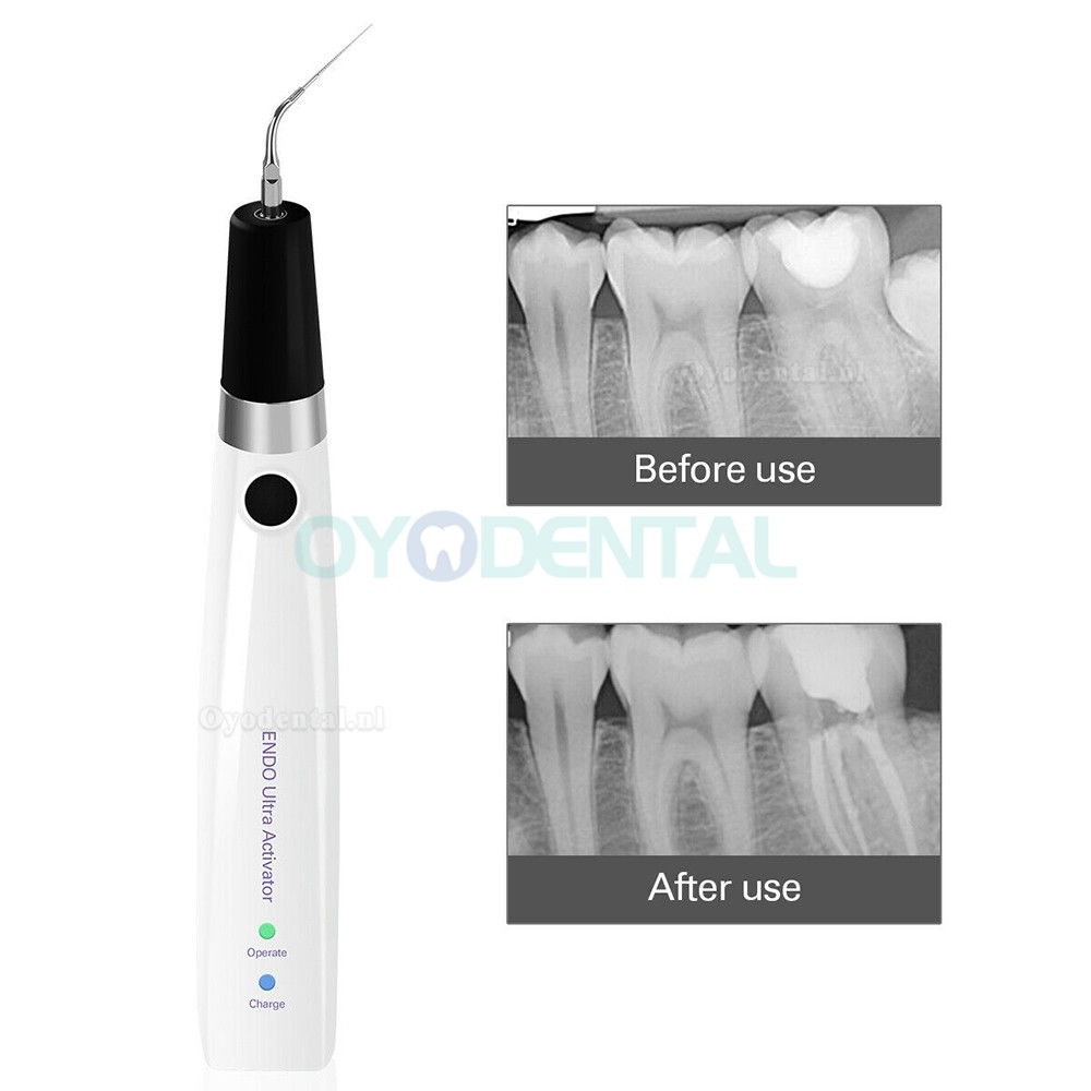 Dental Sonic Endodontische Irrigator Ultrasone Ultra-activator Handstuk + 6 Pcs Titanium Tips