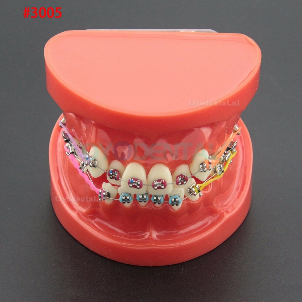 Tandheelkundige Orthodontische behandeling Demonstratie praktijk tanden model