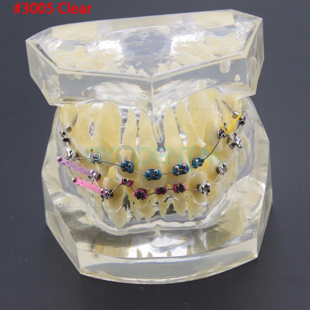 Tandheelkundige Orthodontische behandeling Demonstratie praktijk tanden model