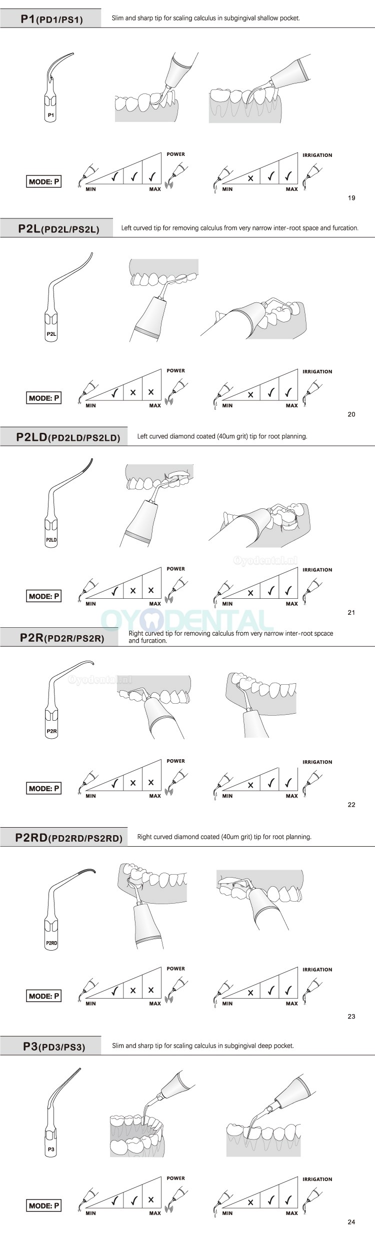 5Pcs Ultrasoon tips P2L P2R P2LD P2RD P5 P6 P7 P8 P10 P11 P12 P14L compatibel met Refine EMS Woodpecker scaler handstuk