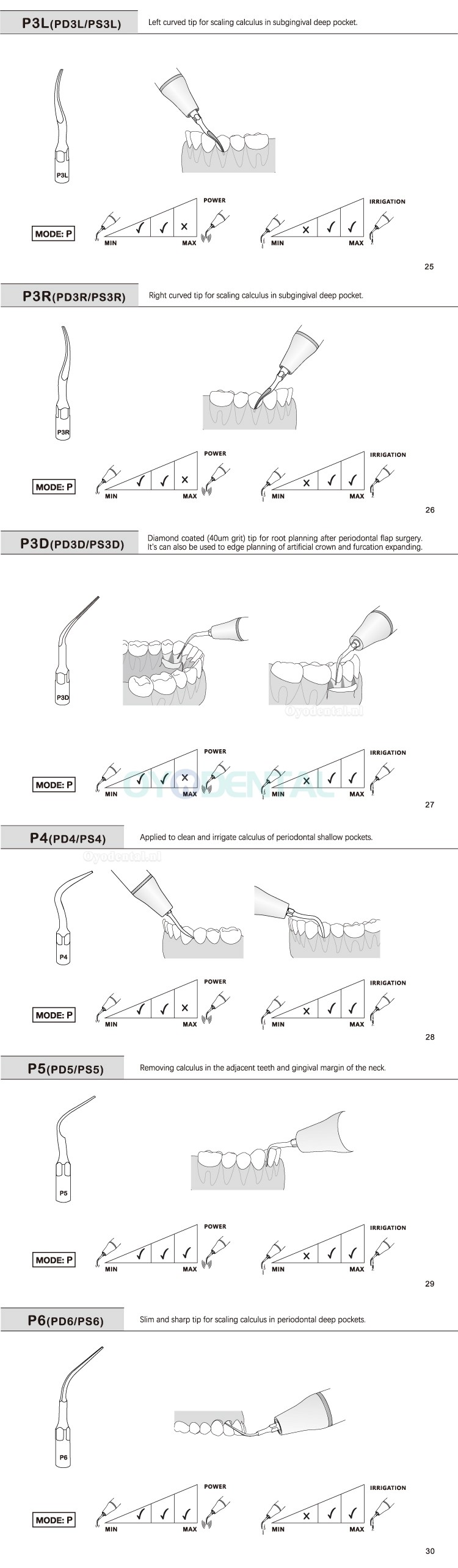 5Pcs Ultrasoon tips P2L P2R P2LD P2RD P5 P6 P7 P8 P10 P11 P12 P14L compatibel met Refine EMS Woodpecker scaler handstuk