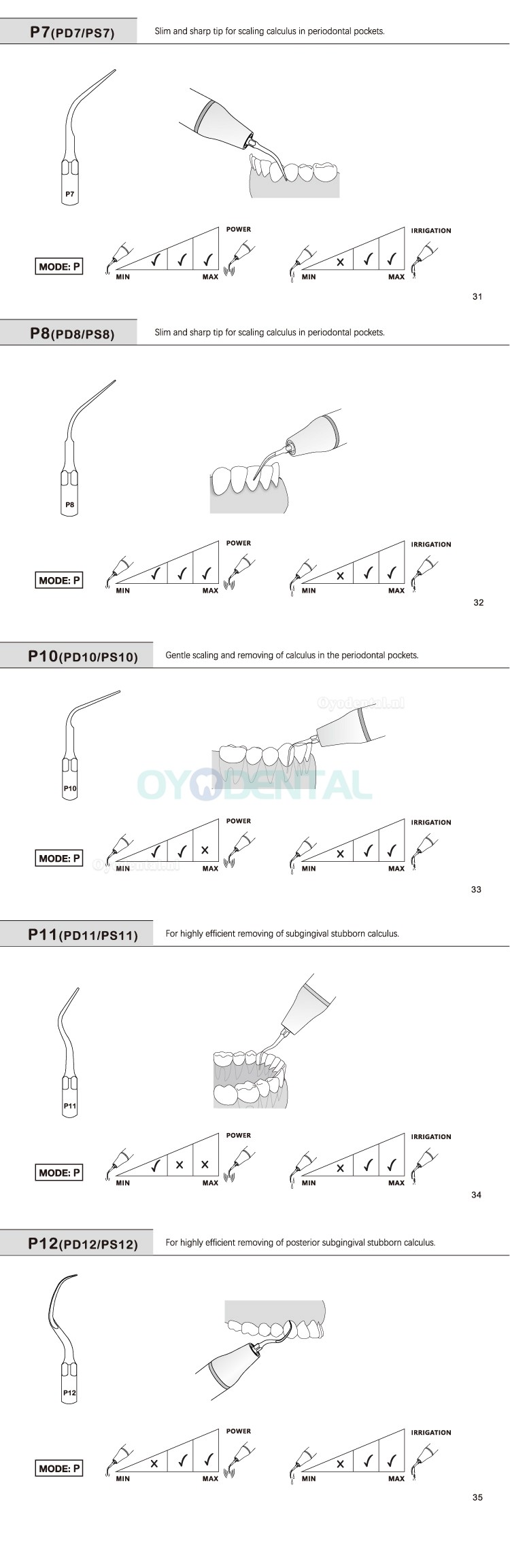 5Pcs Ultrasoon tips P2L P2R P2LD P2RD P5 P6 P7 P8 P10 P11 P12 P14L compatibel met Refine EMS Woodpecker scaler handstuk