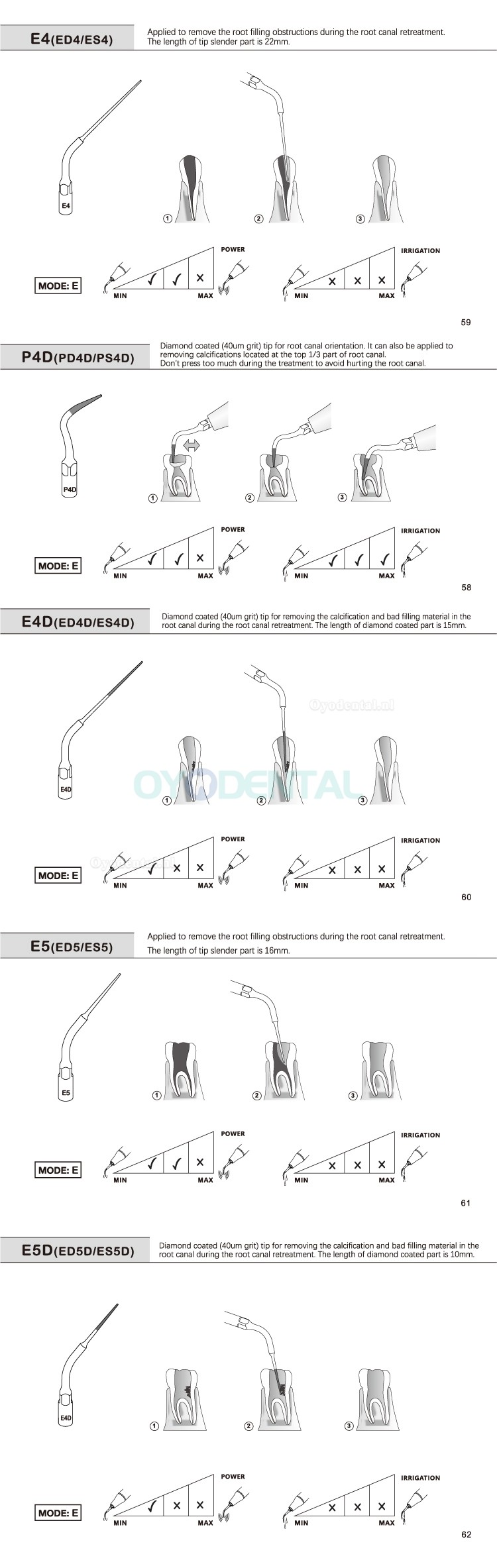 5Pcs Ultrasoon tips Endo E1 E2 E3 E4 E4 E6 E7 E8 E9 E10 E11 E14 E15 compatibel met REFINE EMS MECTRON WOODPECKER