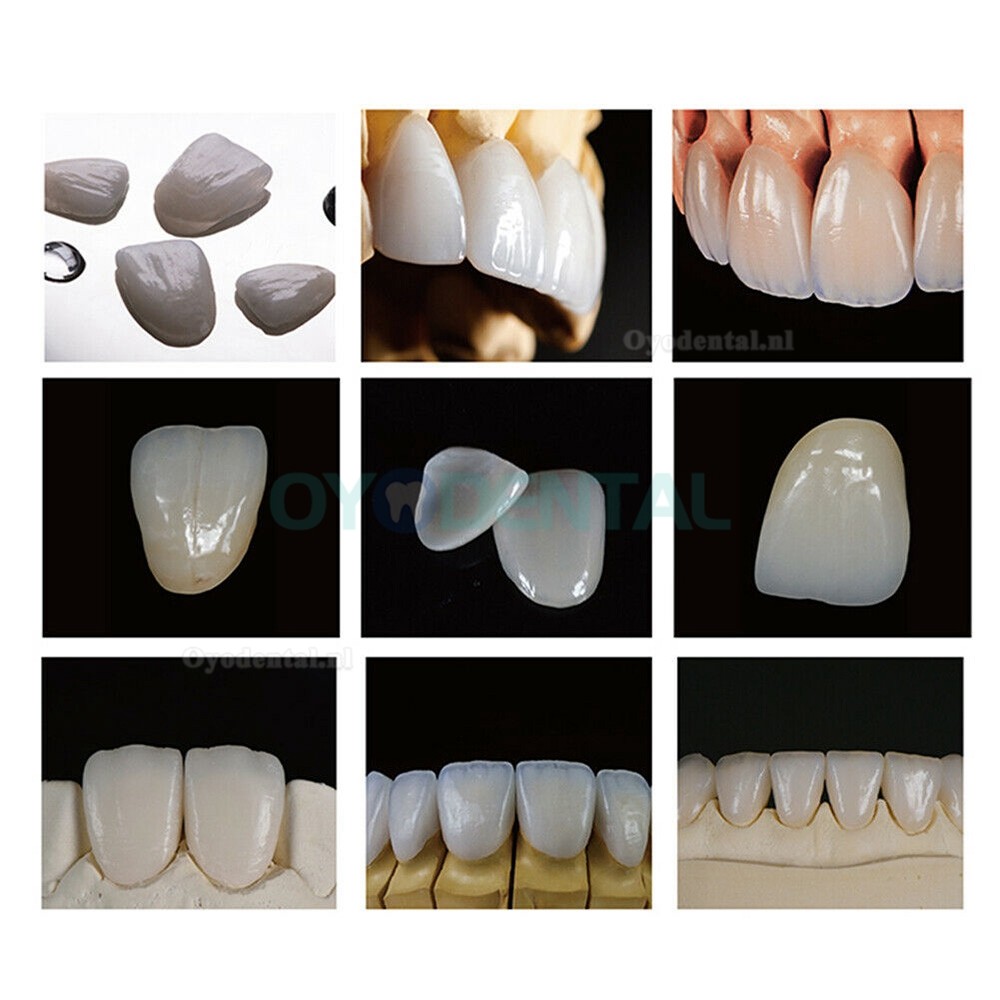 4 stuks B40 Tandheelkundige Lithiumdisilicaatschijven E-max HT/LT cad cam Voor Sirona Cerec